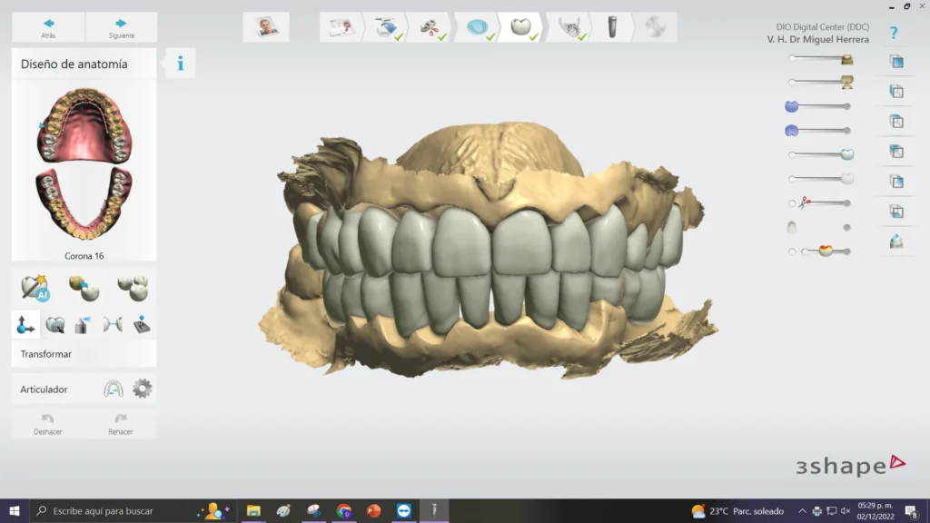 Digital smile design of full-arch teeth in 3Shape software