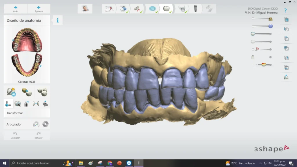 Digital design of upper and lower full-arch bridges