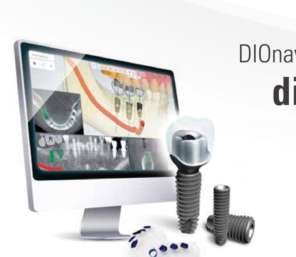 Digital implant planning software, implants and guide