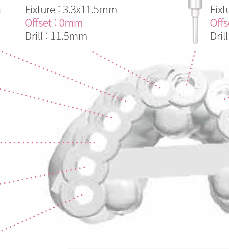 Full-arch 3D printed surgical guide