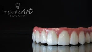 Case 3 · Full mouth – All-on-4 treatment photo 8