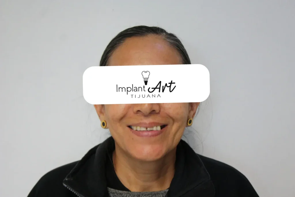 Patient photo, eyes covered for privacy