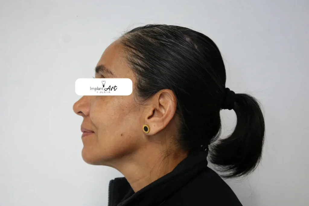 Patient photo, eyes covered for privacy
