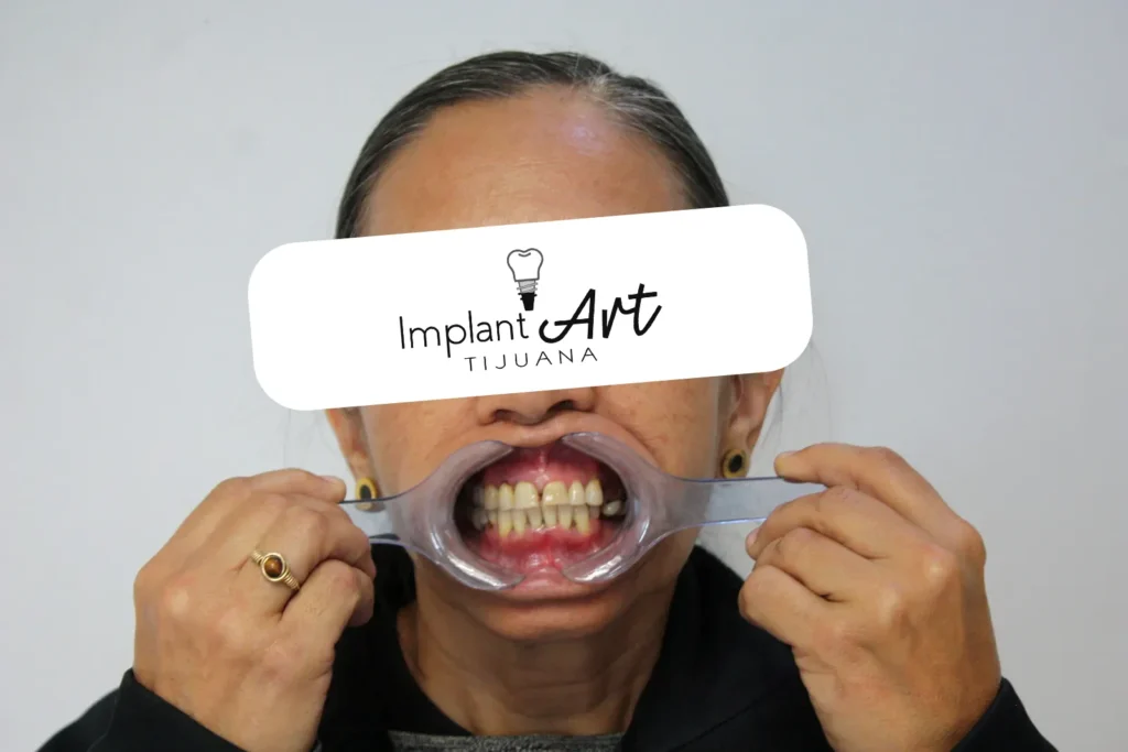 Patient photo, eyes covered for privacy