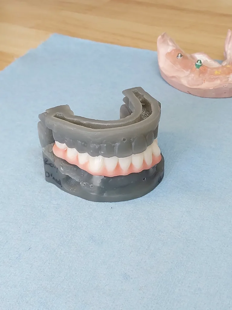 3D printed full arches