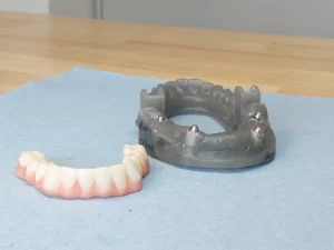 Case 2 · Full mouth – All-on-4 treatment photo 8