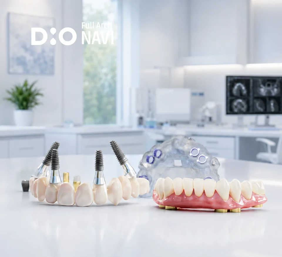 3D Digital Full Arch implants, guide and prosthesis