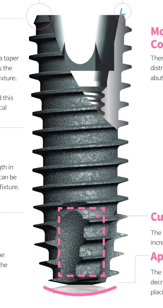 DIO UF II dental implant