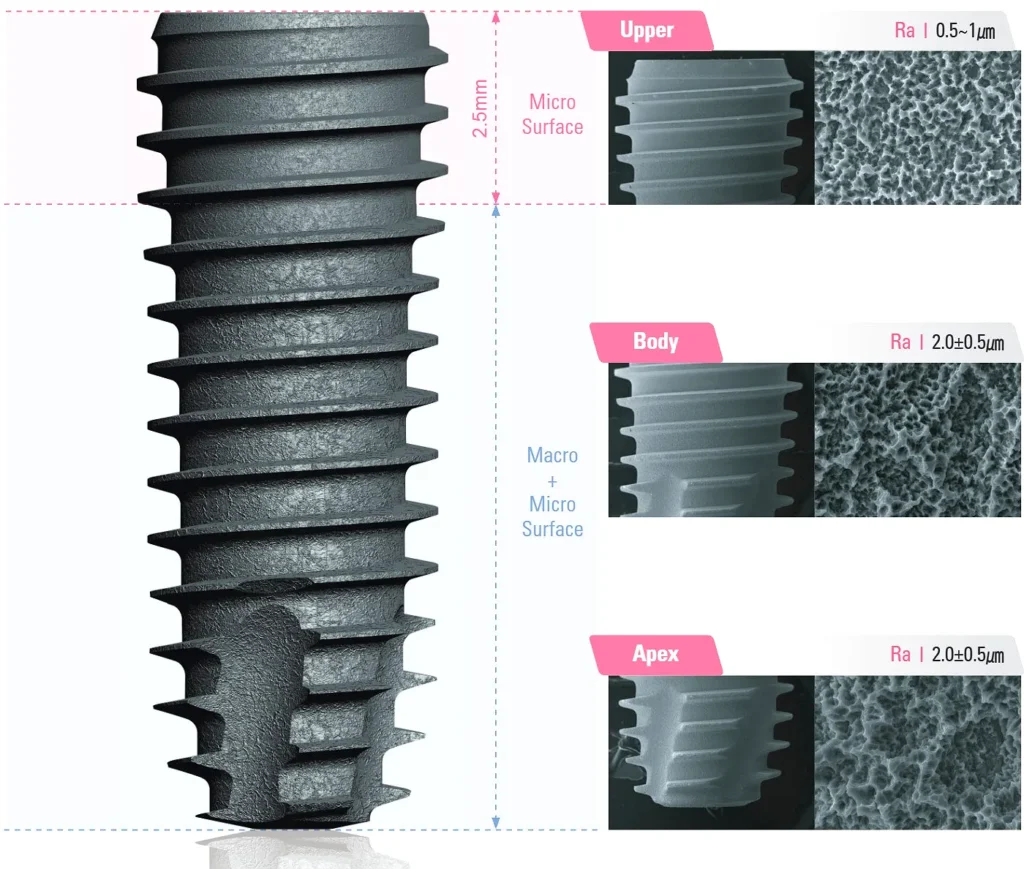 DIO UF II implant surface microstructure