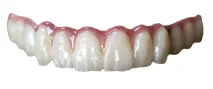 Zirconia full-arch bridge made in the Dental Implant Art lab